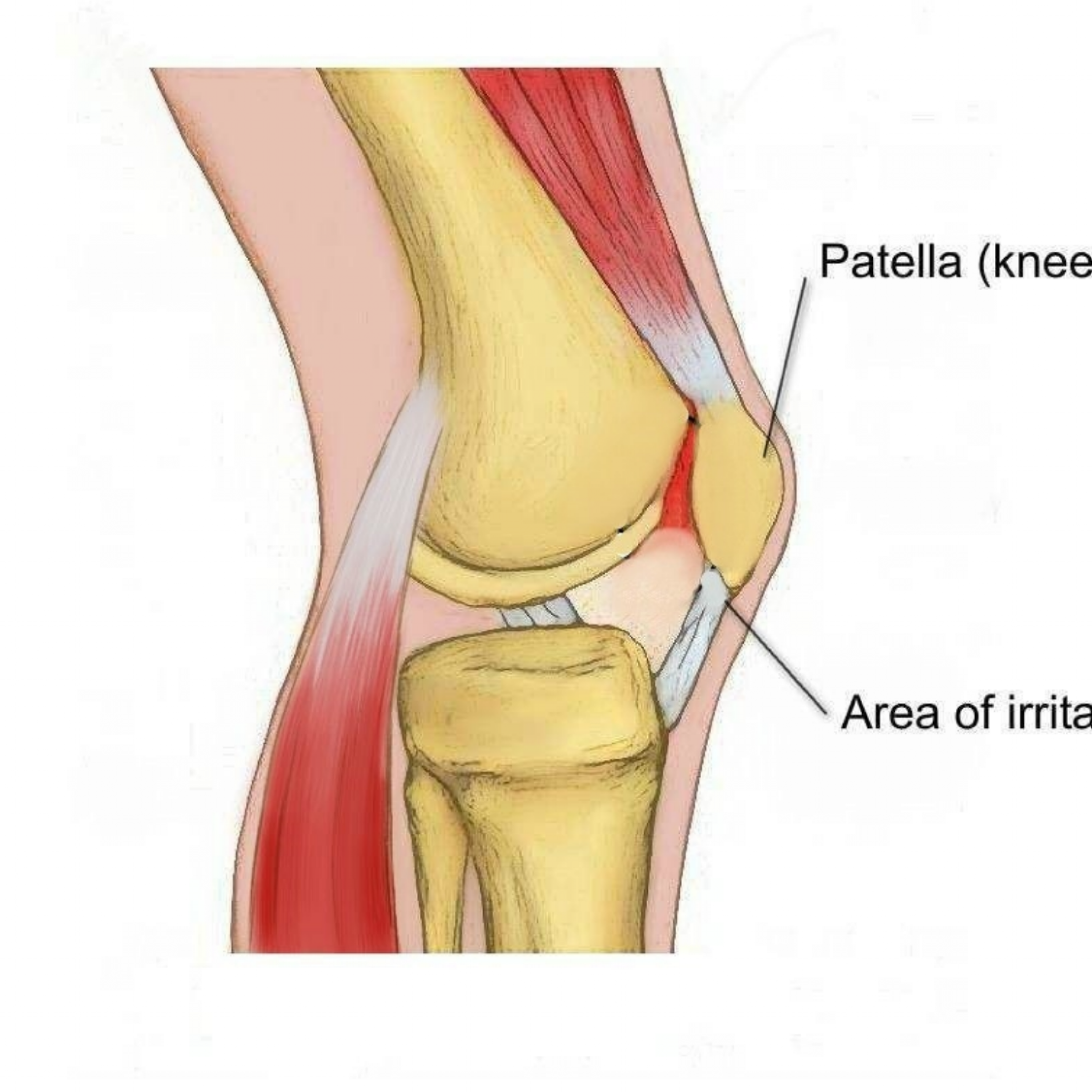 Надколенник коленного сустава анатомия. Patella анатомия. Пателла Альта коленного сустава.