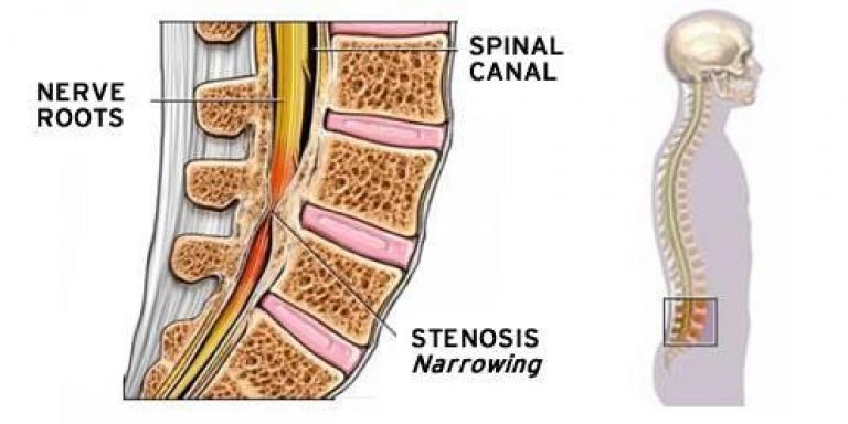 your-legs-feel-heavy-is-it-a-medical-problem-cardiovascular-system