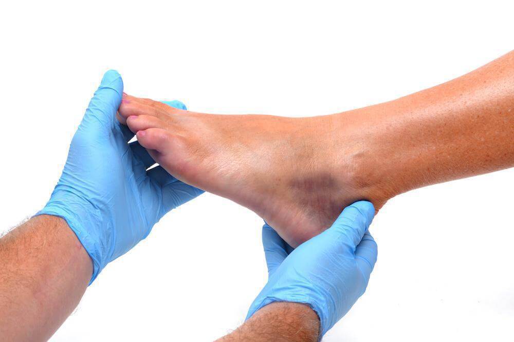 Bursitis Foot Pain: Treatment and Recovery | WalkJogRun